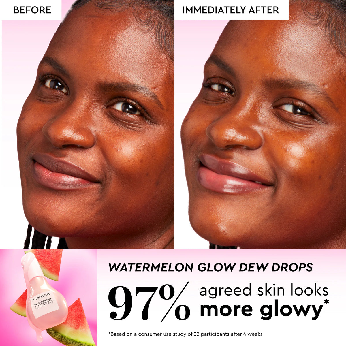 Watermelon Glow Best-Sellers Collection - Your Ultimate Hydration and Radiance Kit