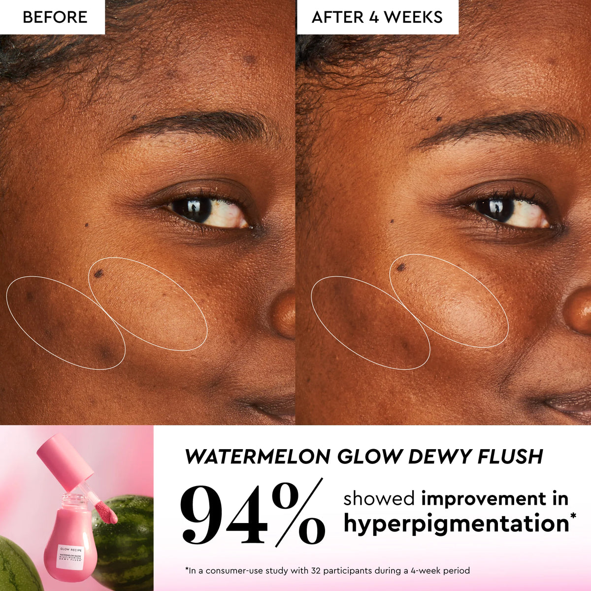 Watermelon Glow Best-Sellers Collection - Your Ultimate Hydration and Radiance Kit